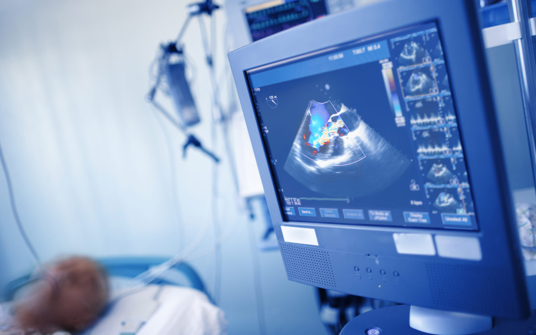 What an Echocardiogram Reveals about Your Heart